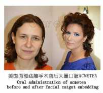 �����ߵ�֮��Ҫע��ʲô���ϰ��̱���·�ϲ�����~~